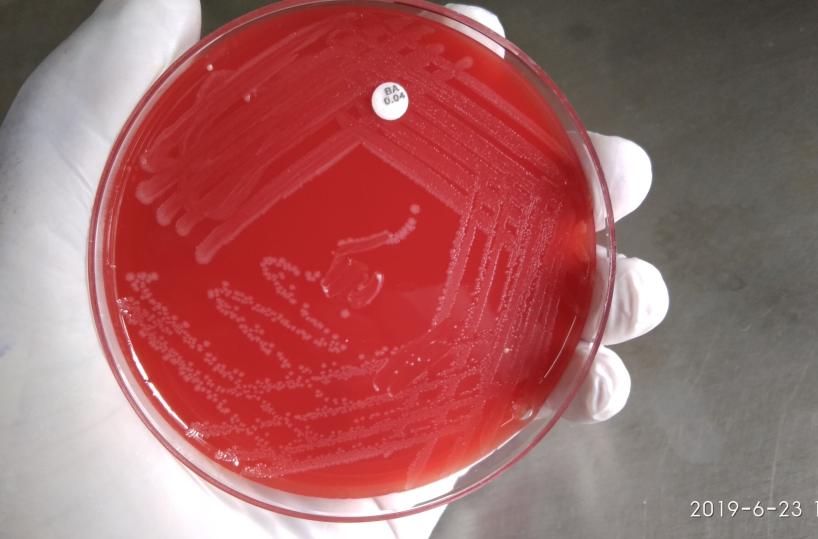 Andria, uomo morto dopo aver mangiato carne cruda: indagini su possibile contaminazione da listeria. Nel mirino una macelleria