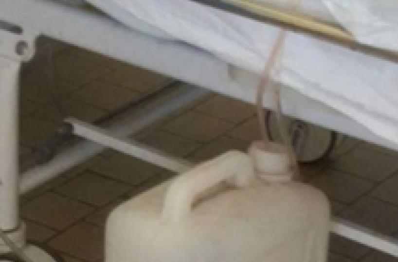 Bidone per lavaggio vescicale, inchiesta