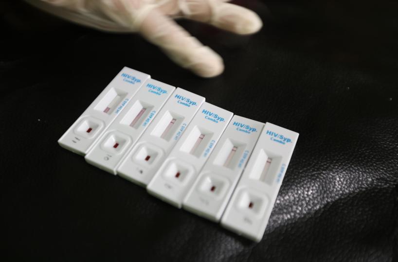 Oms, metà delle diagnosi di Hiv in Europa arriva troppo tardi