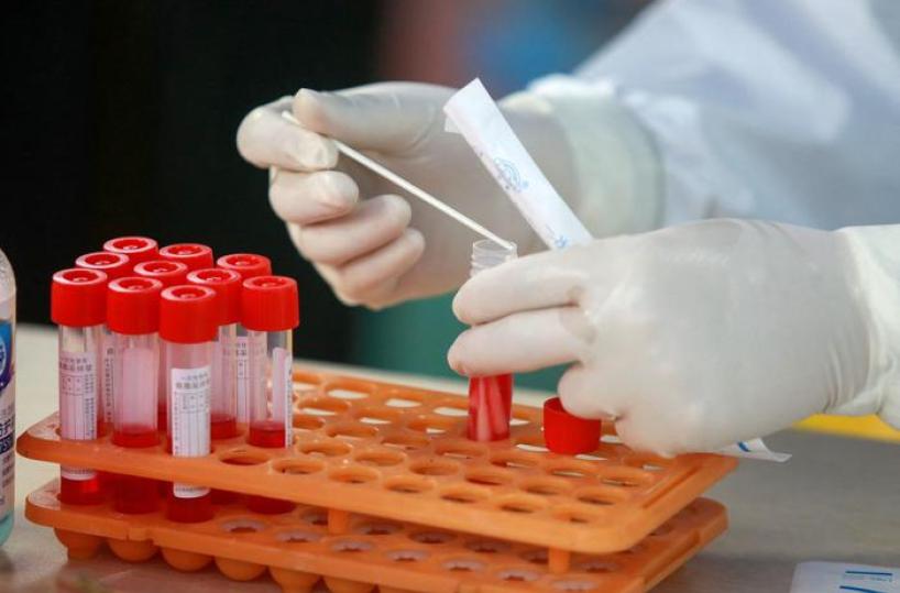 Pechino consenta indagini indipendenti su origini e diffusione del Covid
