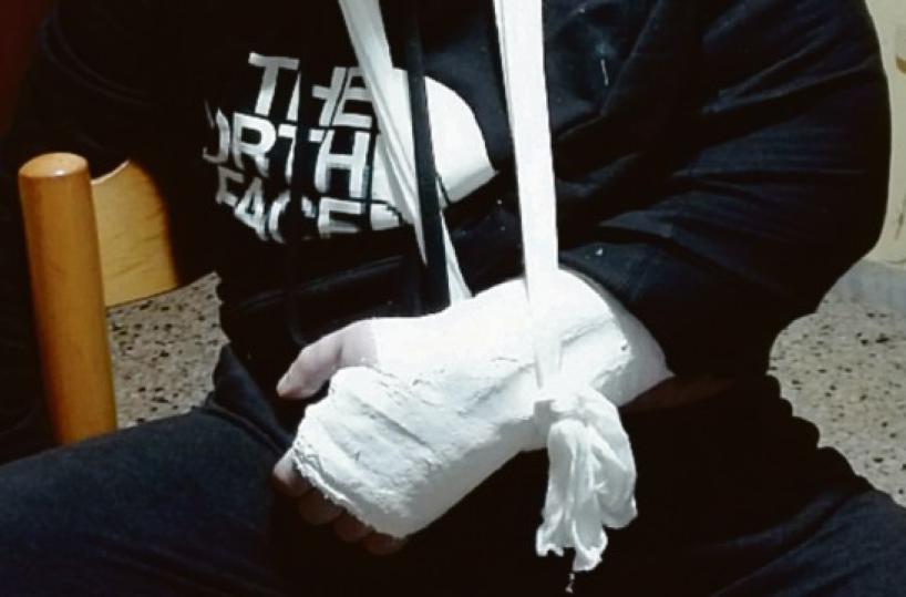 Disabile deriso e pestato dal «branco» a Conversano: ha un braccio fratturato