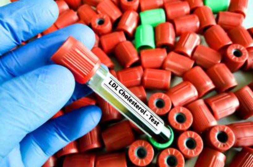 Colesterolo Ldl, per abbassalo in sviluppo nuova terapia con tripla combinazione&nbsp;
