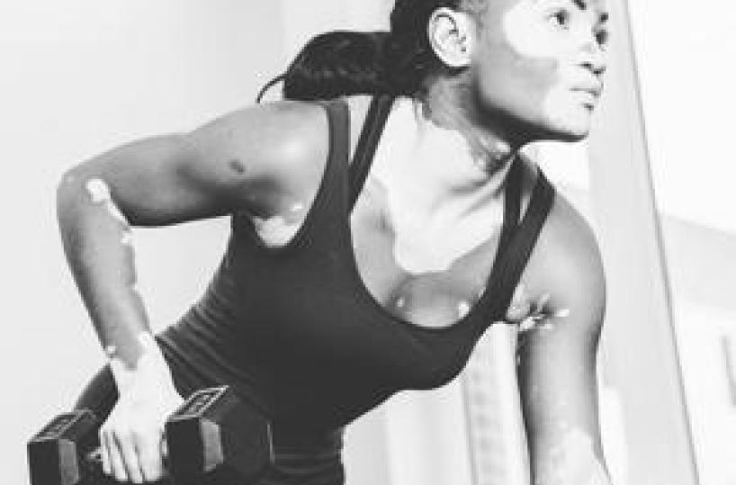 Vitiligine, "così la terapia della luce aiuta il farmaco"