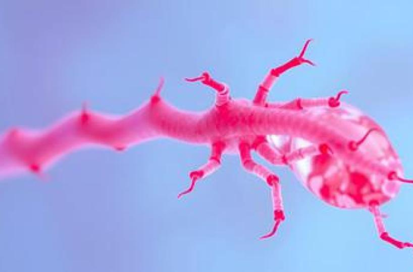 Miastenia, in Sardegna su mille pazienti stimati solo metà nel registro