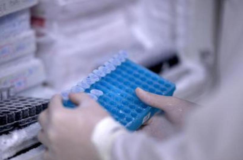 Scoperto il virus gigante Ushikuvirus, lo studio: "Pu&ograve; darci indizi su origine della vita"