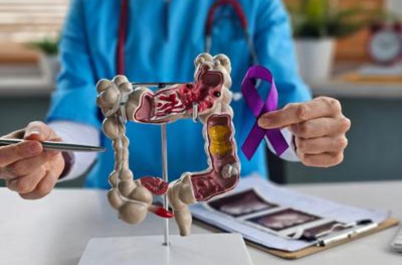 Tumori del colon retto, Int Milano in progetto Ue che punta a prevedere efficacia immunoterapia