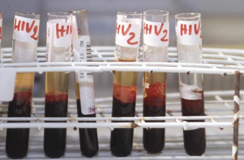 Hiv, oggi a Bari incontro su terapie long acting e prevenzione