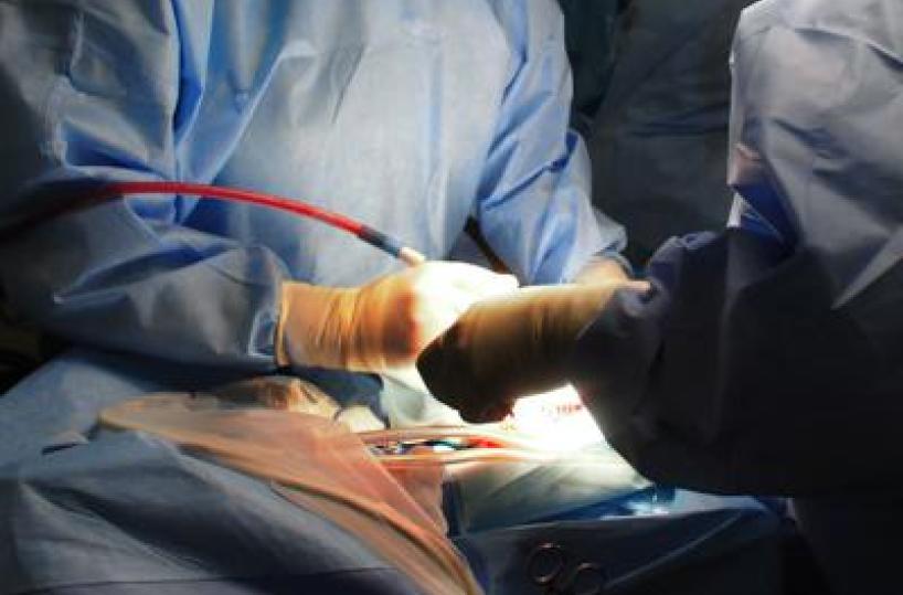 Trapianto di fegato completamente robotico, a Padova la prima mondiale con tecnica innovativa