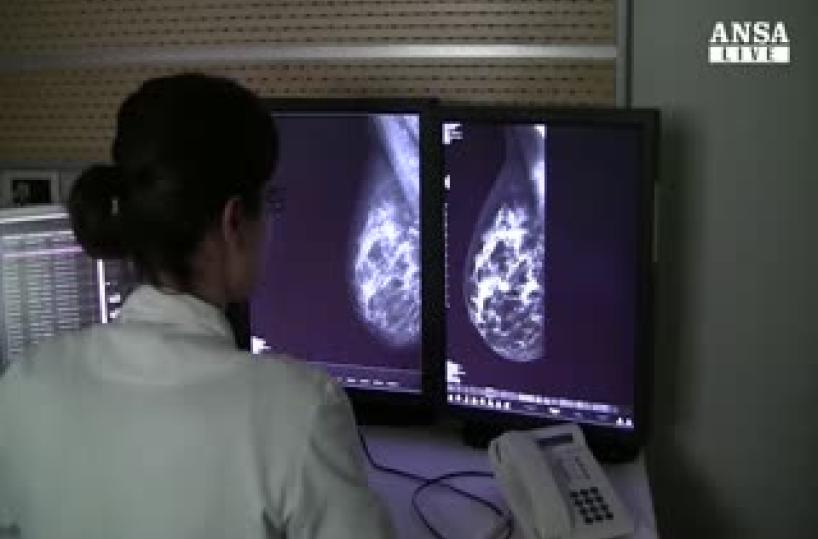 Puglia, tumore seno in 10 donne che lavorano di notte in  ospedale
