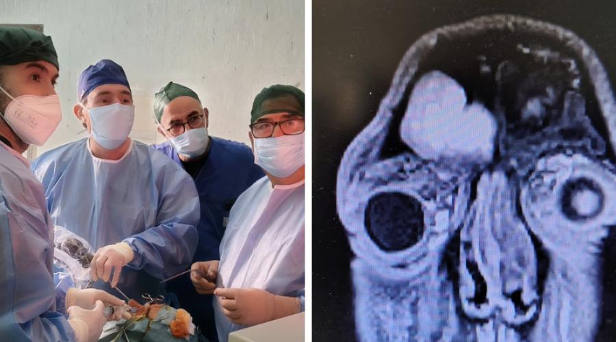 Bari, 37enne recupera la vista dopo un intervento d&rsquo;urgenza al Policlinico: aveva una grave complicanza sinusale