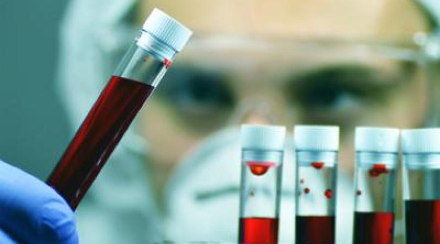 Comuni abitudini che falsano esami e test, medici svelano quali sono