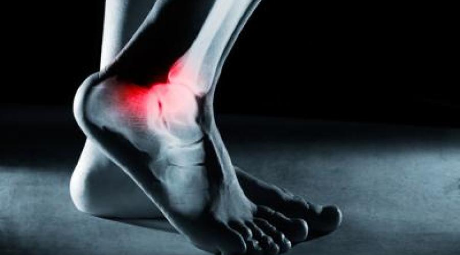 Ossa fragili dei calciatori, ecco perché post ritiro tanti soffrono di osteoartrite