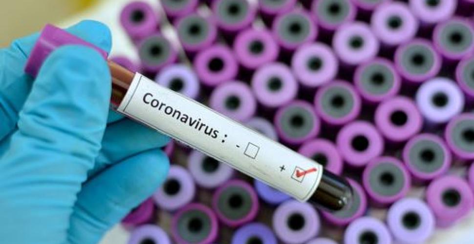 Coronavirus