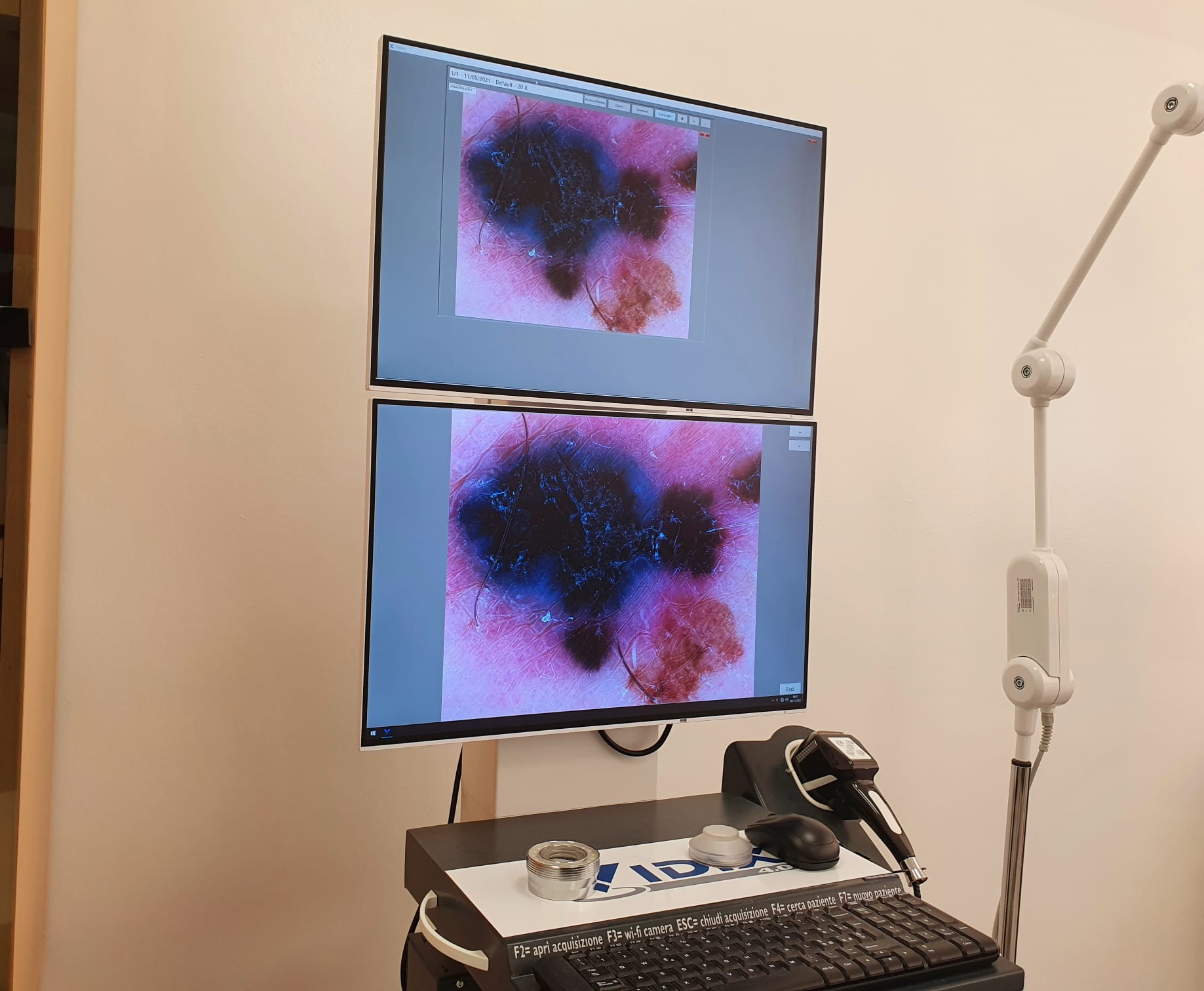 https://www.lagazzettadelmezzogiorno.it/upload/2022_05_11/Videodermatoscopia_computerizzata-1652277301059.jpg